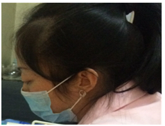 1482567795916645.png blob.png